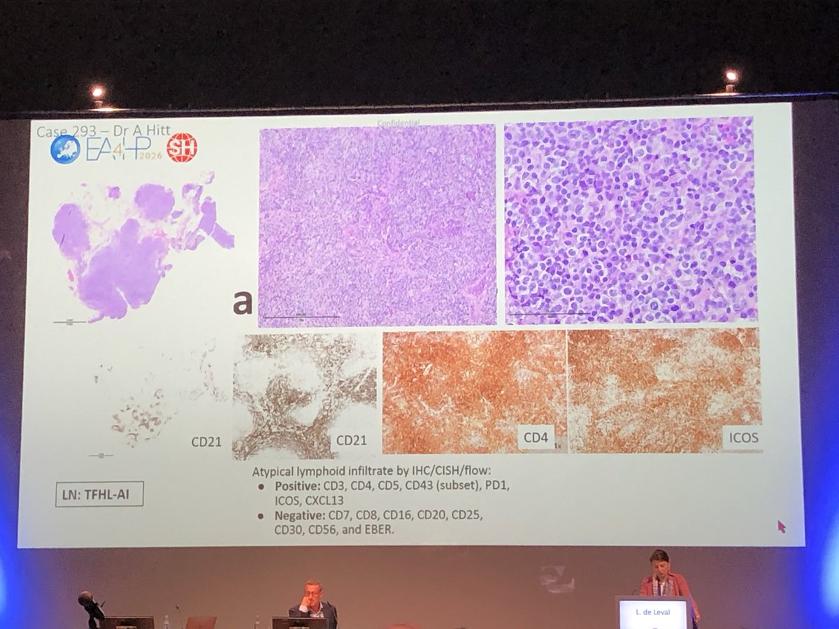 MaracajaDLV's tweet photo. @DukePathDept being represented at #EA4HP / #SH in Berlin today. 
🔬Dr. De Leval presented our case with such an interesting flower morphology in TFH lymphoma, angioimmunoblastic type! 
Great job Abbey Hitt! 

Also, congrats for Dr. Tran Nguyen and @Luis_F_Carrillo for another case presented. 

Pictures credit Dr. Elena Fenu