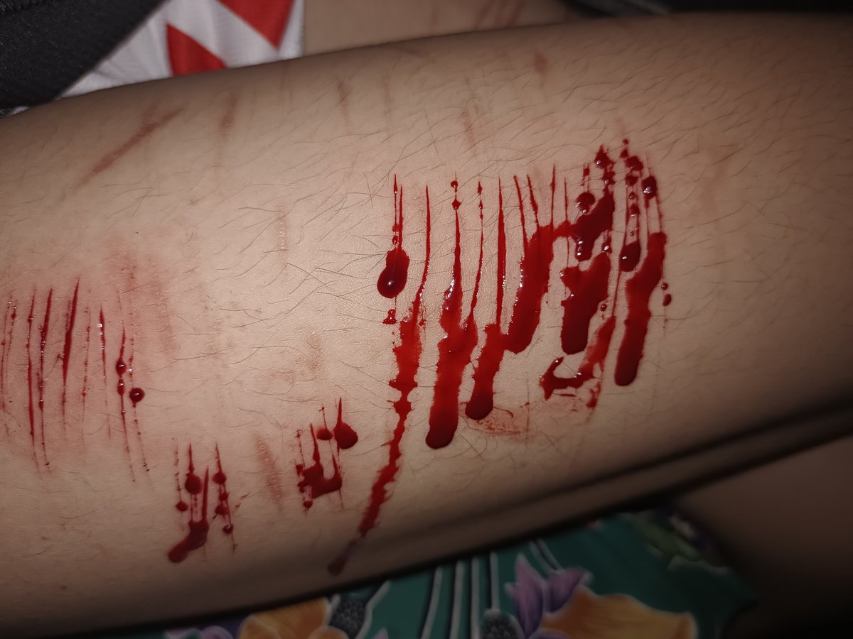 sl1tmeout's tweet photo. Fake blood! Sfx, all FAKE! 

Old pic but i like it. 
#shhtwt #slittwt #shttwt #relapse https://t.co/Frb8cqlemG