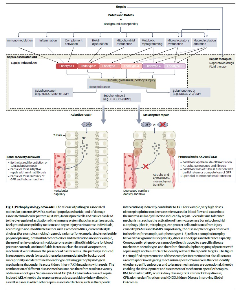 edgarvlermamd's tweet photo. Sepsis-associated AKI (SA-AKI): Pathophysiology
#Nephpearls #AKIinICU
๐ Organ dysfunction during sepsis develops even in the absence of decreased O2 delivery (Hypotension and ischemic injury are not the sole cause)
โ ๏ธ Other mechanisms include microvascular dysfunction, endothelial injury, alterations of cellular metabolism, and immune system dysregulation
โ ๏ธ Variations in renal microcirculation, diffusion
limitation from edema and inflammation, production of reactive oxygen species, and damage to the endothelial barrier and glycocalyx likely contribute to the structural and functional changes
โ ๏ธ Sepsis treatment related factors, such as exposure to nephrotoxic drugs and hyperchloremia, can also indirectly contribute to SA-AKI
๐ https://t.co/MYgINCCbZ6
