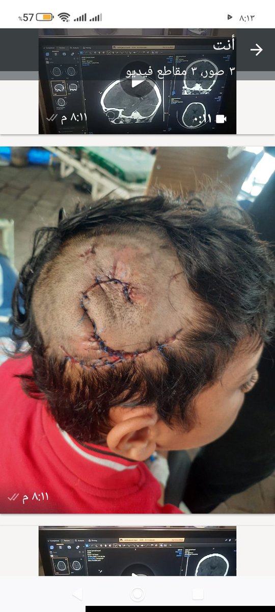 jamaldader2011's tweet photo. Save Jamal so he can return to a normal life like other children. https://t.co/29ZXgmZIBv