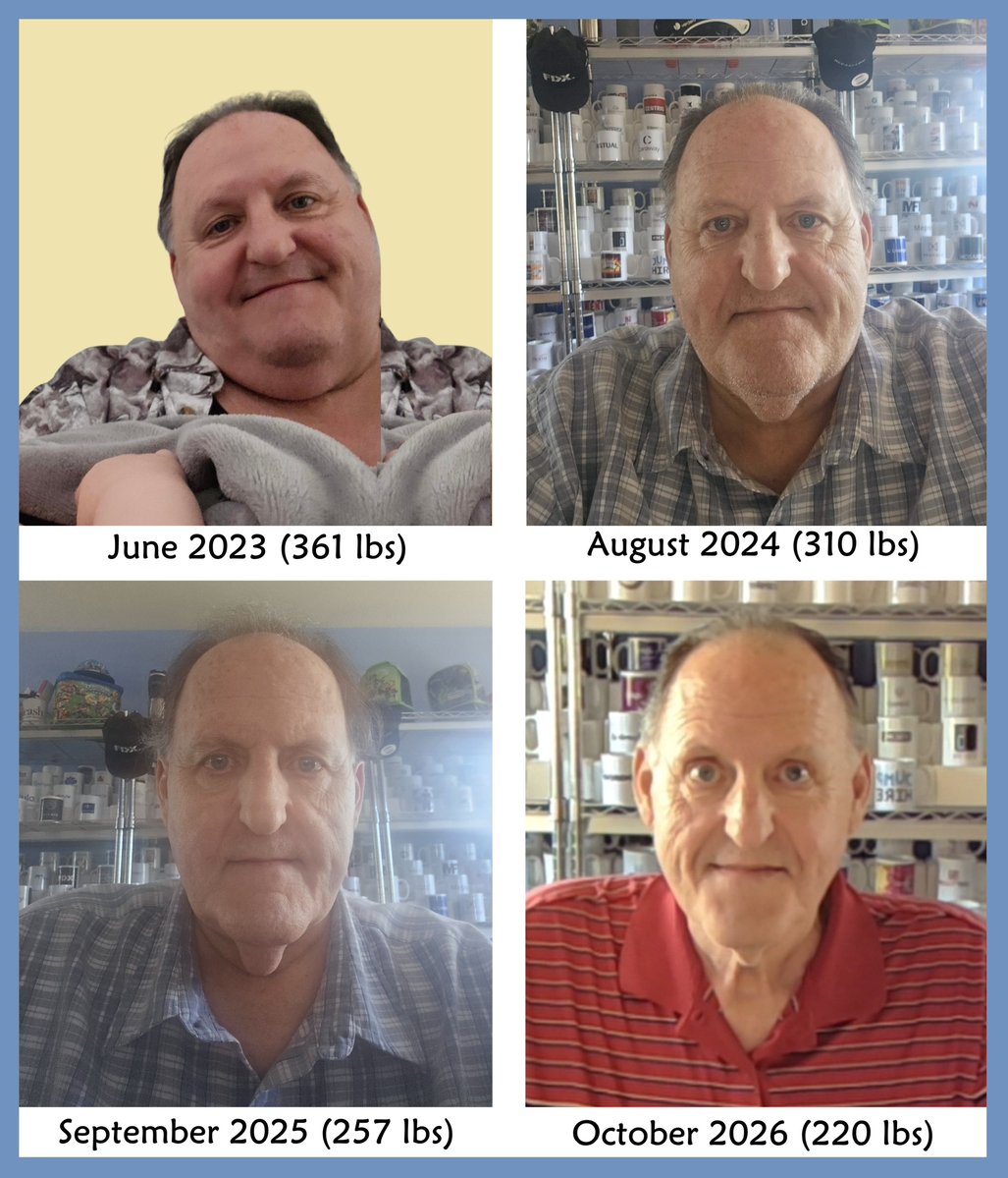 WhereWords's tweet photo. PERSONAL UPDATE: When I blew my knee out in 2023 (google “meniscus root tear”) my ortho surgeon said he would try to fix it but I would be looking at a knee replacement if I didn’t get some weight off. Since then I’ve lost 141 lbs, about a pound per week for 3 years. Along the way I lost 2 inches from my wrists, 4 inches from my neck, 8 inches from each thigh & a whopping 16 inches from my waist. Best of all, I have no pain in my knee & will not need a knee replacement any time soon.