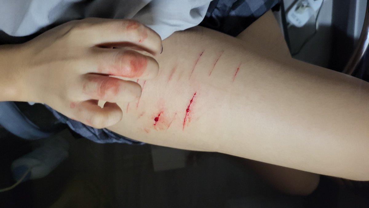 huii109's tweet photo. That time I just don't understand why I punch at the wound either lol https://t.co/flUQwIK5yw