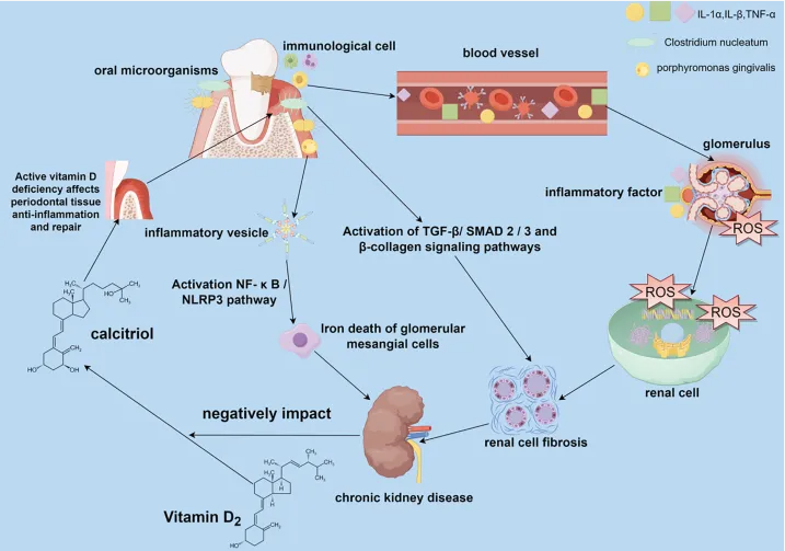 DrGrahamLJ's tweet photo. 'Oral pathogenic bacteria can be transferred to the kidneys via the bloodstream and contribute to renal pathology, causing renal cell fibrosis ...'

👇👇👇
Li et al 2025
Periodontal disease and chronic kidney disease
https://t.co/lMYjCAc1u7 https://t.co/7hcs03qKEj