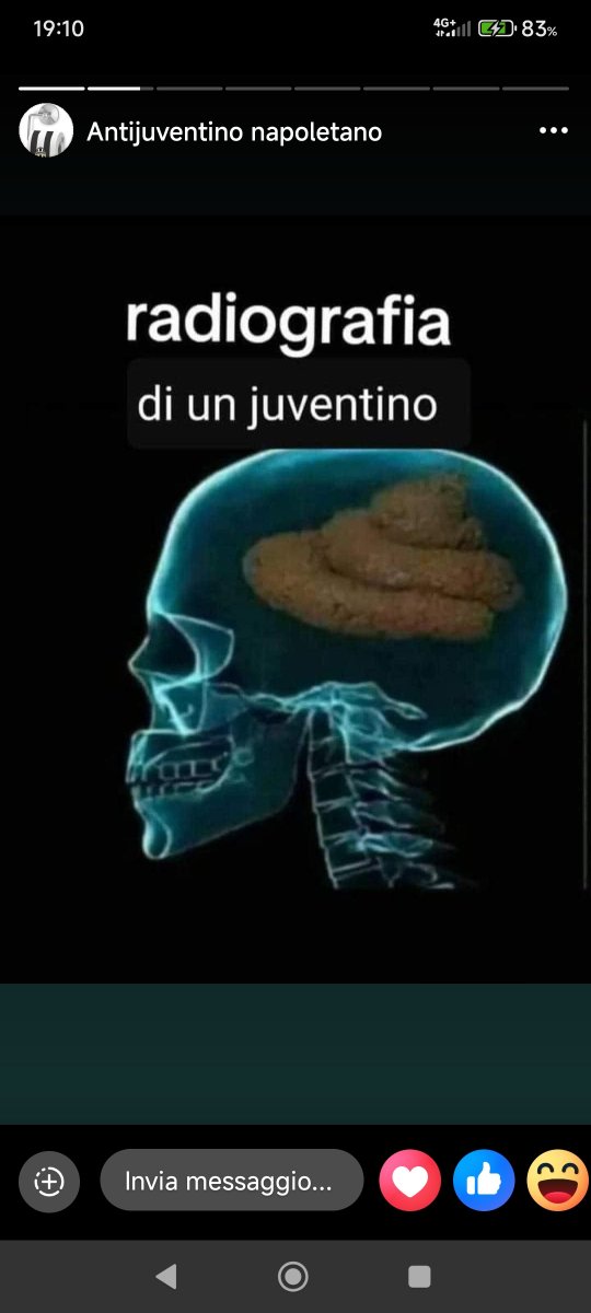 RafK08923928's tweet photo. @JUVE1897__ @TizianaV277948 @AleAlfio1 Era una relazione tra due ragazzini CON LEI CONSENZIENTE, cari caproni ipocriti, giudicati ed assolti! Ma il contenuto cranico di un cataplasma rubentino che caxxo può capire... https://t.co/4R2gBlGieu
