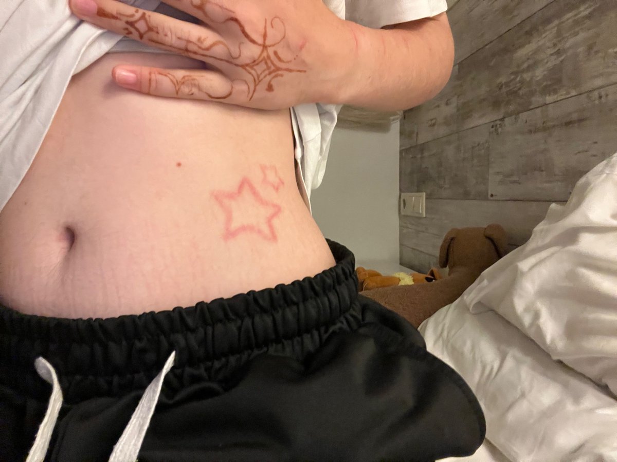 Mybigaaahballs's tweet photo. Here are also both my scarifications healed now #scars #scarification #sh #shtwt https://t.co/DttOQmxJ0O