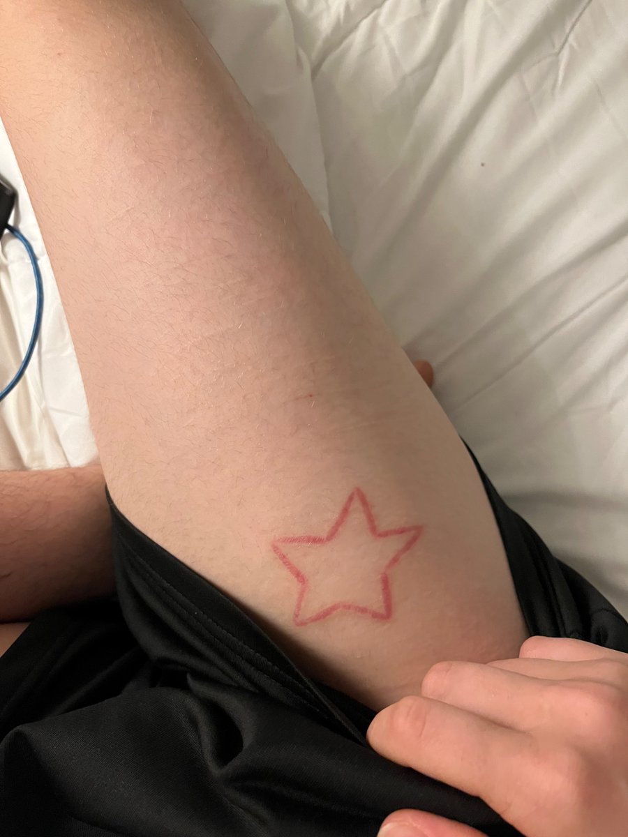 Mybigaaahballs's tweet photo. Here are also both my scarifications healed now #scars #scarification #sh #shtwt https://t.co/DttOQmxJ0O