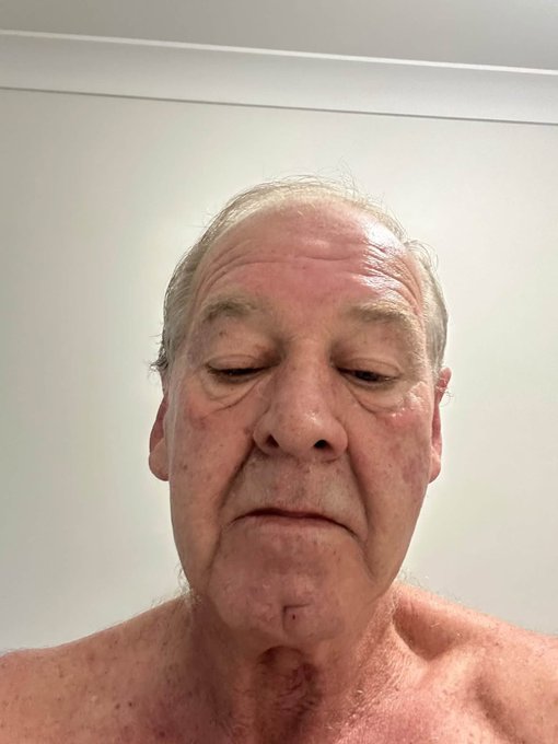 A close-up portrait of an older man with fair, sun-damaged skin and short light hair looking downward with his eyes nearly shut.