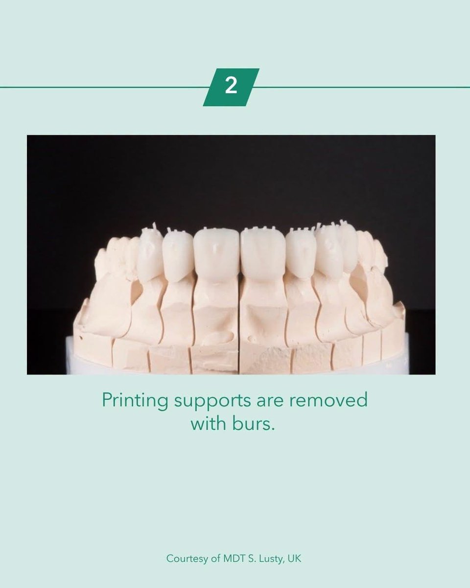 drAnasabdo's tweet photo. •Long term provisional in full mouth reconstruction.
• التعويضات المؤقتة طويلة الامد.

Courtesy: GC
#endo_prostho_ortho
#EPO
#DrABDO
•You can ask …!!
•follow me: https://t.co/pRUIAesvUY