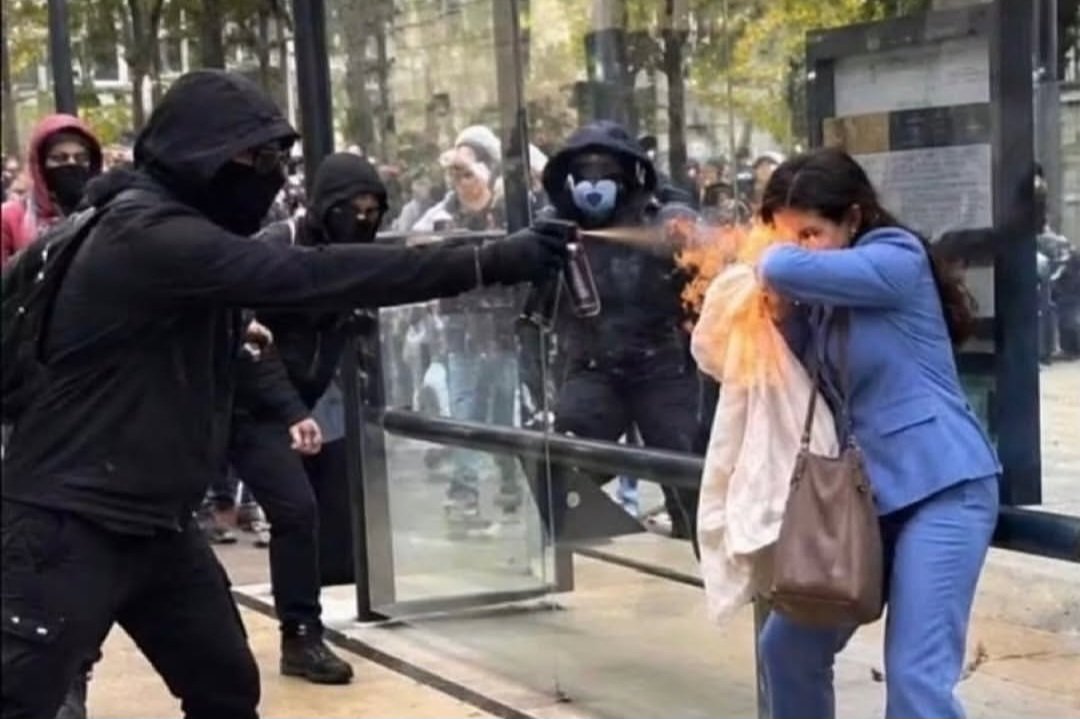 SuperTito200's tweet photo. Ismic terrorist burn up the woman's face, but for the far left Media the problems in Europe is the right wing 
#farleft #islam #islamistheproblem @bbchausa @BBCWorld #paristine #Paris #terrorism https://t.co/K1E4sYvCdm