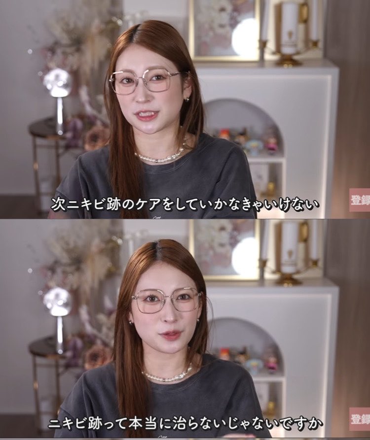 angel___1999's tweet photo. ニキビ跡消すのにレーザー高いお金払って痛い思いするくらいなら家でコレ使って‼️

美白に特化しまくりなのに、ニキビ跡とかシミも消してくれて優勝。チクチクする美容液苦手なんだけどこれは全然使える。 https://t.co/9VRhCLkOCg