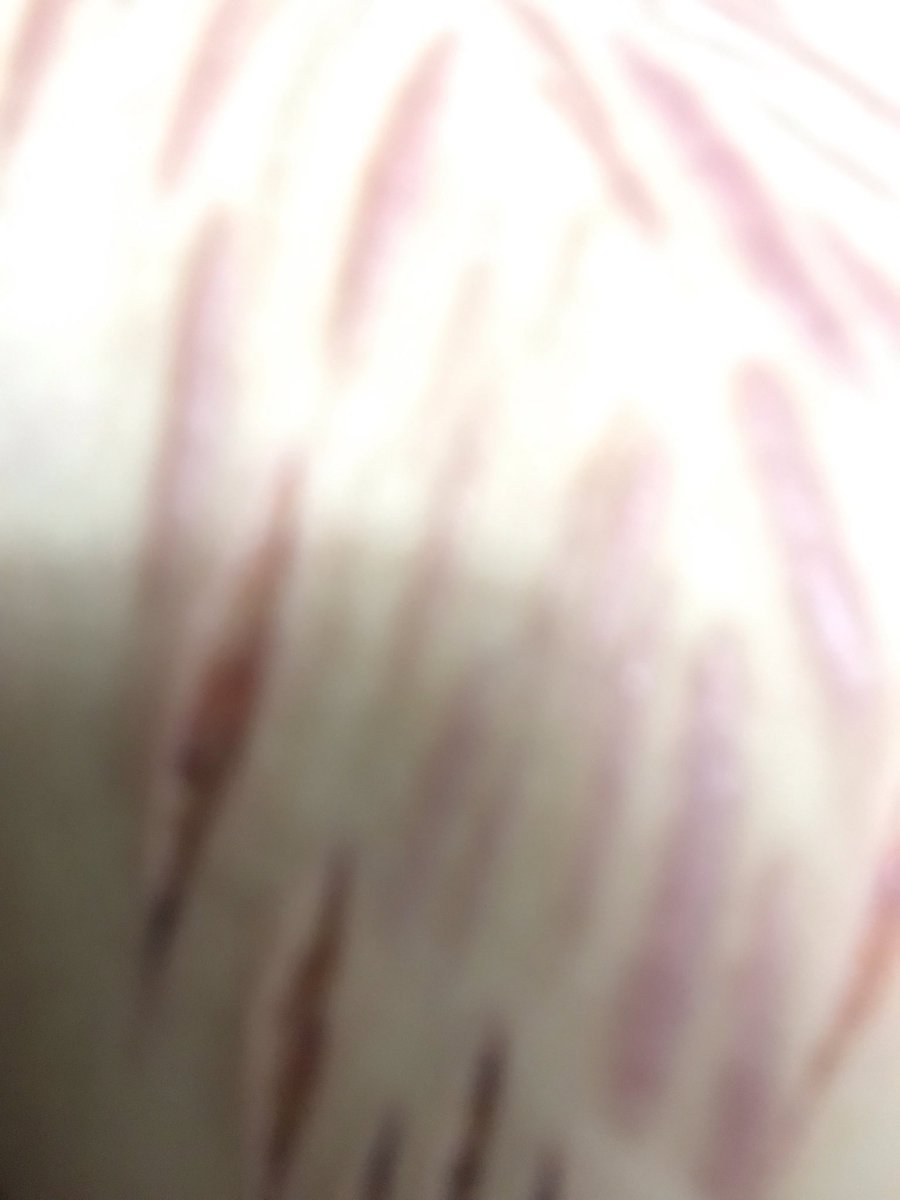 dermisbaby's tweet photo. Am I the only one who loves my own cuts and scars aha https://t.co/msY91hVGum