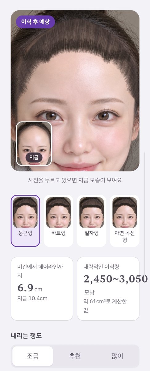 popopota07's tweet photo. Chat Gpt가 사랑한 그녀의 변신
헤어라인 이식 고민 중이라면!
내 사진으로 네 가지 모양 미리 보여 줘요 👉
https://t.co/RXc5rs4cM7 https://t.co/KOObhfSrLy