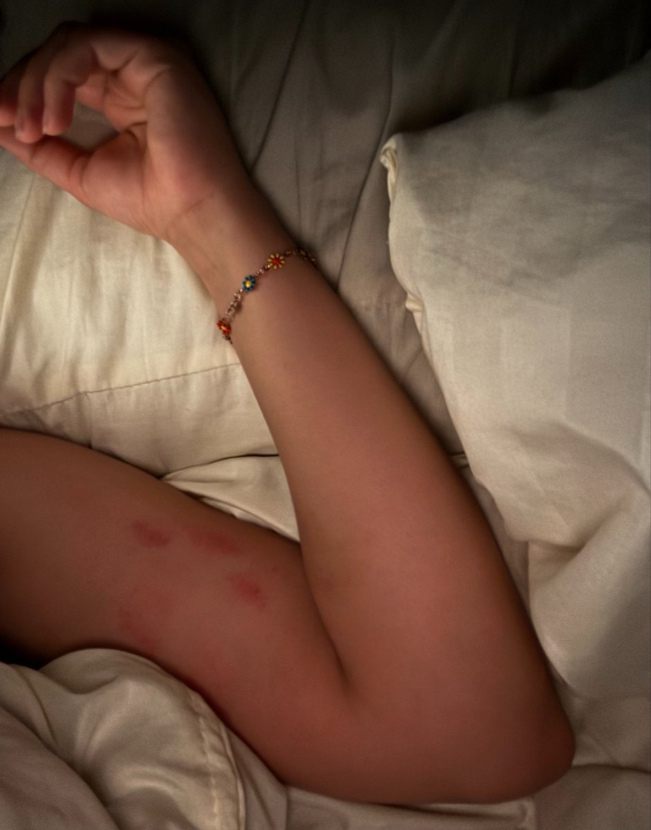 Afugitive_'s tweet photo. Self-inflicted kisses
The situation is out of control https://t.co/nIF7GGluXz
