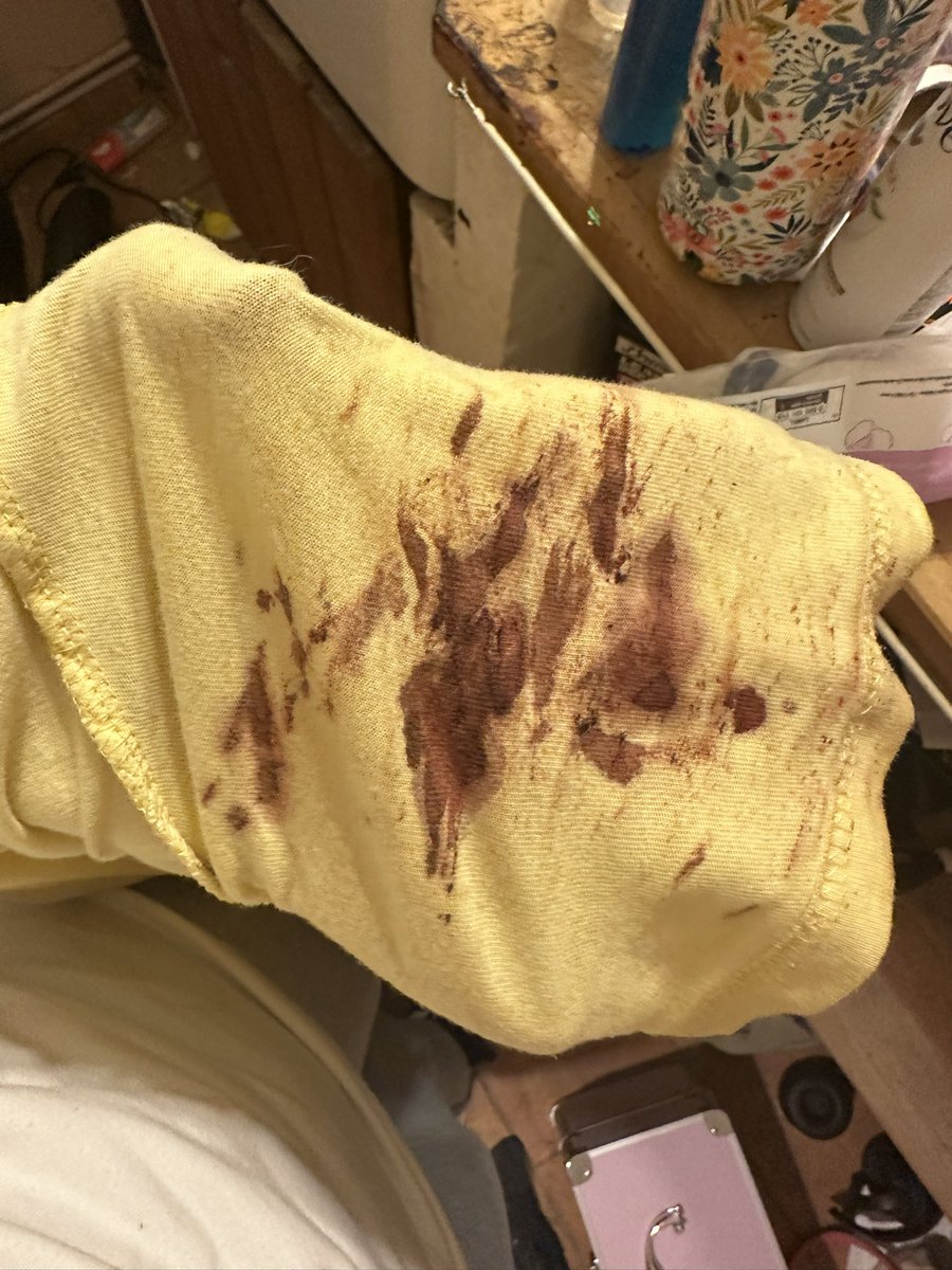 mcupcakess's tweet photo. Throwback to when my cuts re opened while i was at my gf’s house and my sweetheart cleaned my cuts without a word or being disgusted. Gosh im dating an angel https://t.co/m8TVclB2Ud