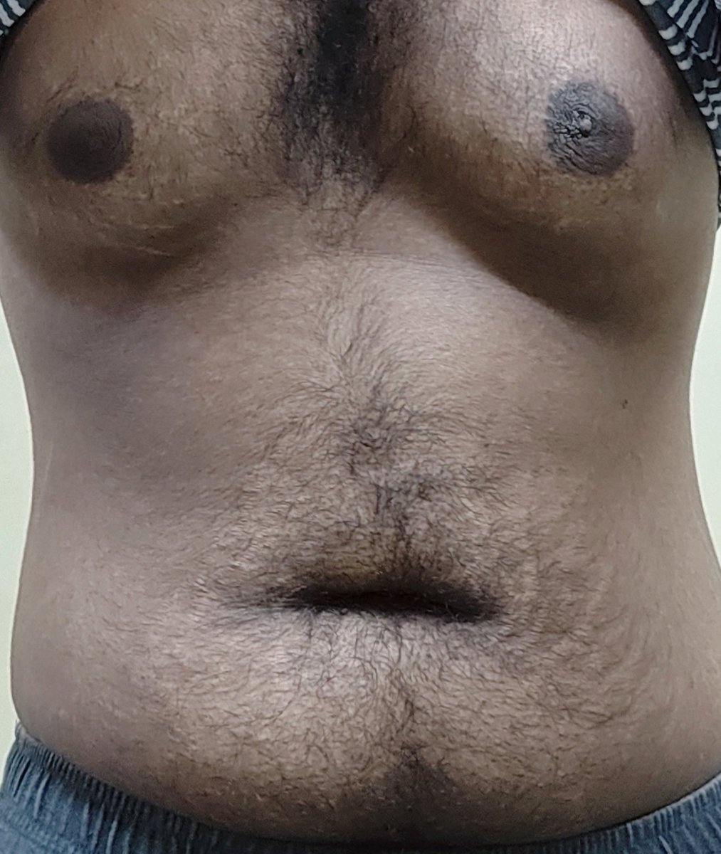 SWorst36012's tweet photo. Do you like my man boobs? https://t.co/W1mxzFUt1V