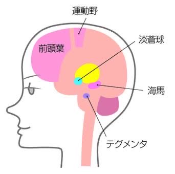 kintoretoo's tweet photo. 脳を健康に保ち、認知症を避けるには、運動すること

運動すると記憶を司る、脳の海馬という領域の機能が維持、向上する
しかも運動すると、脳の健康に欠かせない睡眠の質の向上にも役立つんだ
#筋トレ https://t.co/f1YwLKKwED