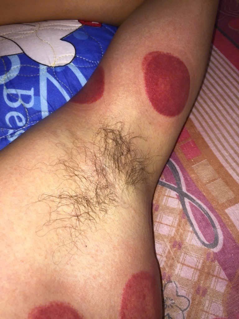 Mintyprdn's tweet photo. Long an cạo gió miễn phí https://t.co/czt6biRwNW