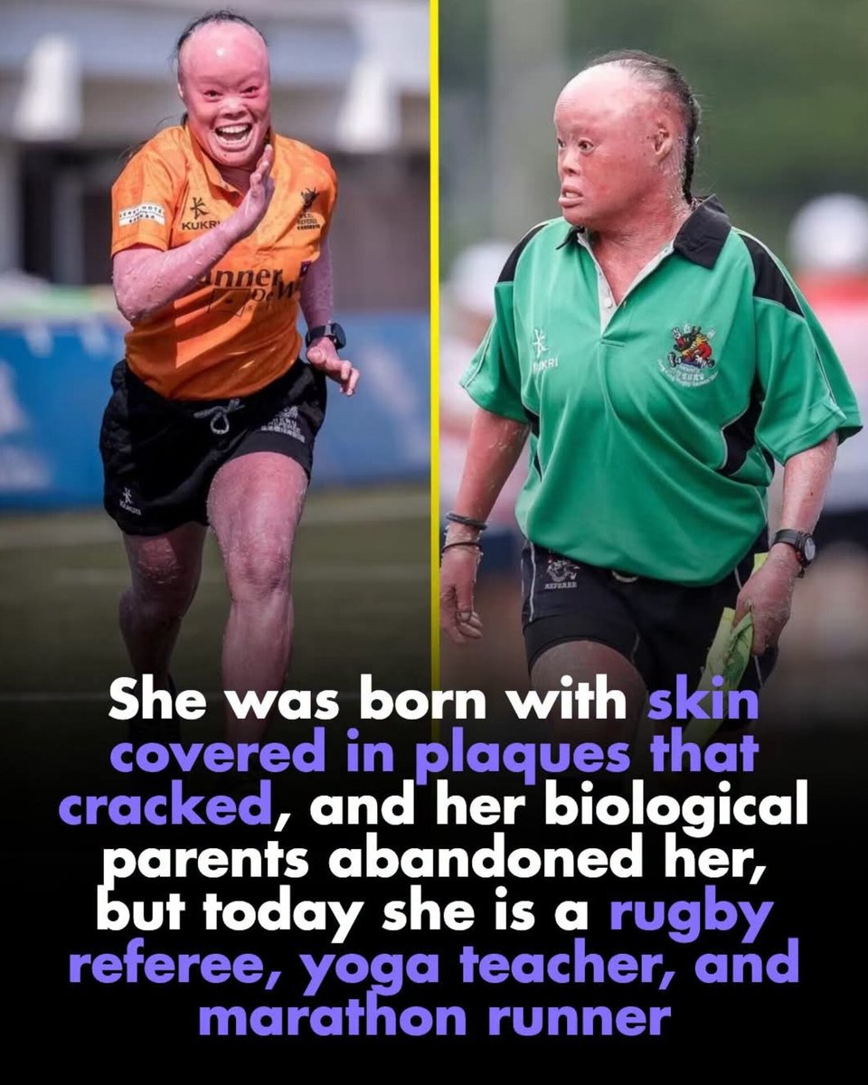 worldranking_'s tweet photo. She was abandoned for being different, but she turned her struggles into strength. What an inspiring woman! ❤️ https://t.co/TdbiVums8N