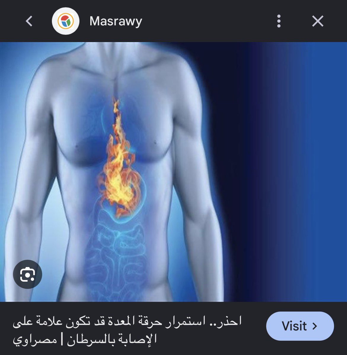 oGttf3's tweet photo. الله من همٍّ قبل يذّن الفجْر
قام يتلاهب من ورا الحِدَّب العوج

الجمر وسط الصدر والدمع فـ الحِجْر
والقلب منّه ياعرب صار مفلوج

ما تكفي الونّة ولا ينفع الزجْر
لاقام يصفق فالحشا صفقة الموج
🚨🚨🚨🚨🚨✍️
الحرقان بسبب الكرسبي ناشفيل ولا اشارة على اصابتي بالسرطان اتوقع الاولى https://t.co/QkNK2BERjA