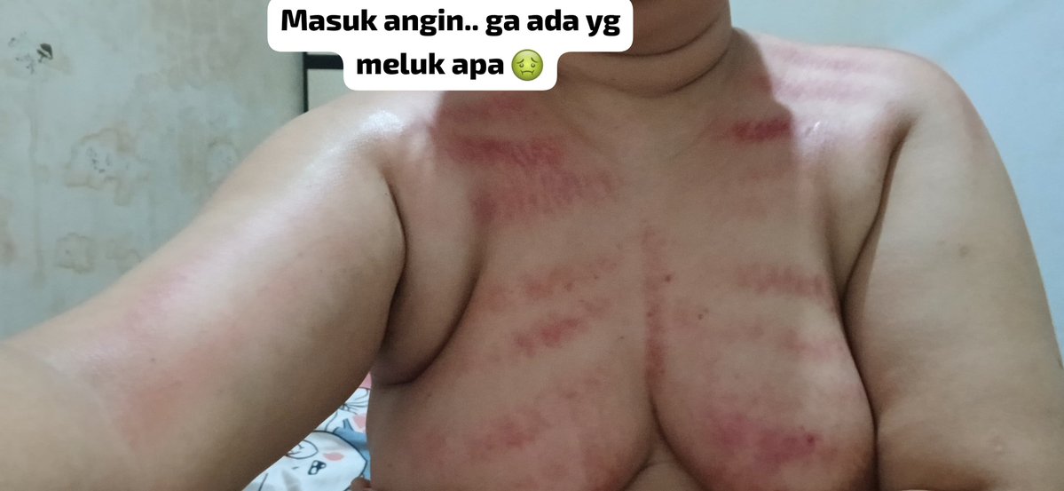 Iisherli88's tweet photo. 🤢🤢🤢🤢 https://t.co/hlqsuCJW9x