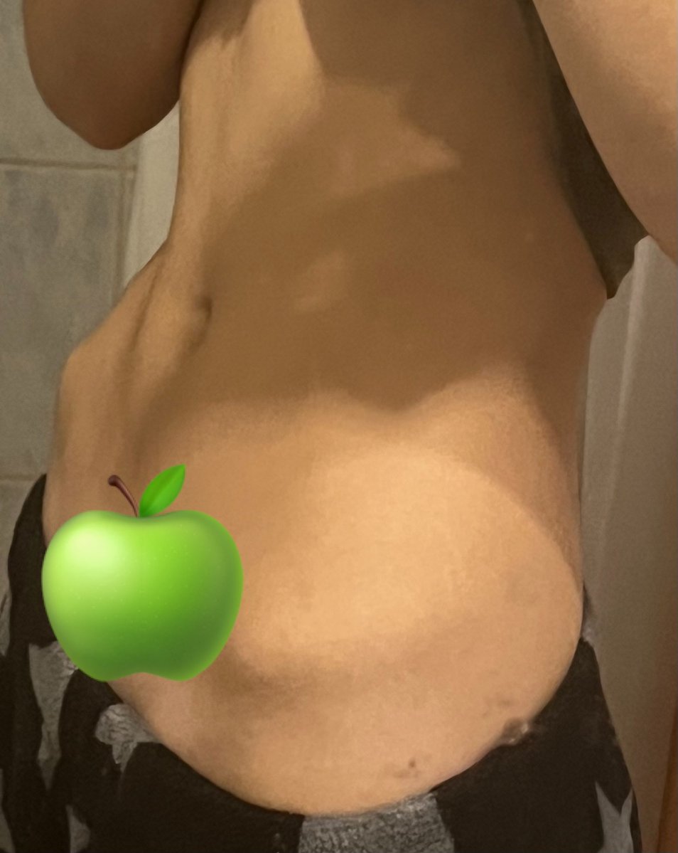 BartyOfShedtwt's tweet photo. I feel so fucking huge i do not look bmi 17 what is wrong with my stupid fucking body i want to kms (ignore my dirty mirror) #bc #edrtwt https://t.co/COkAgeeI8f
