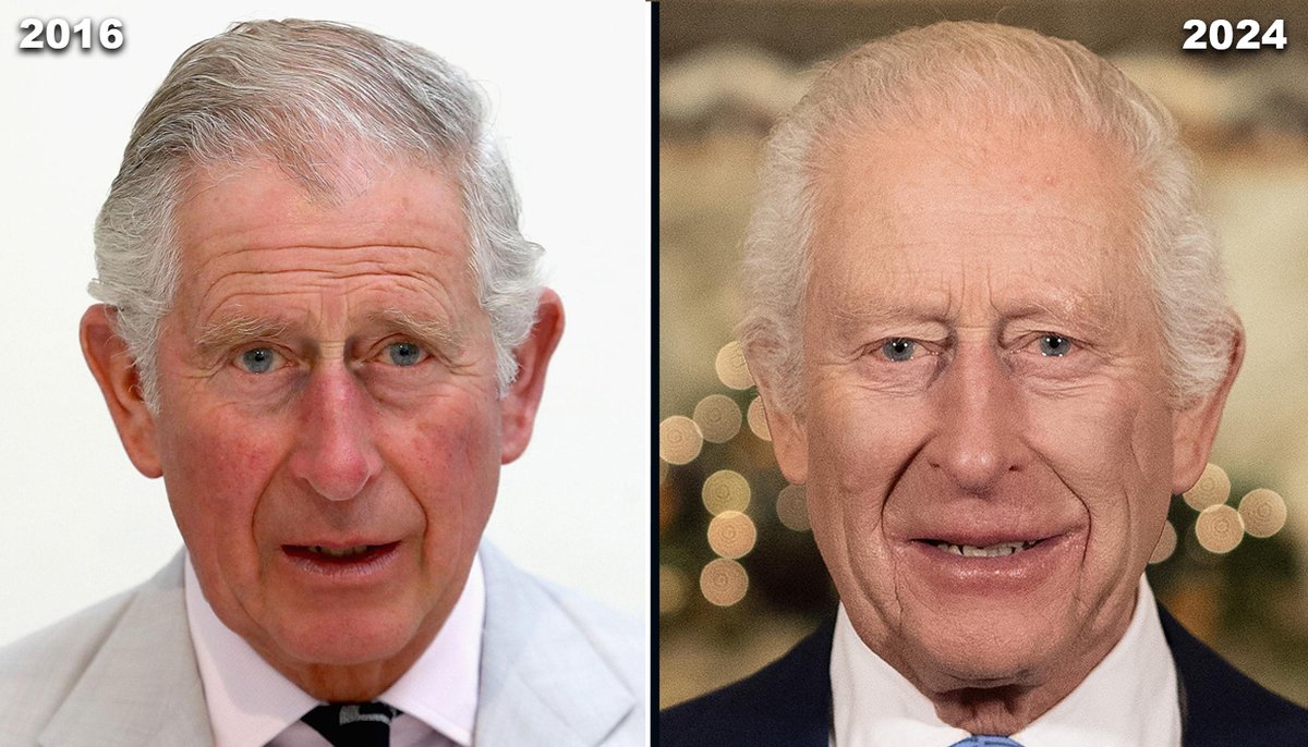 MatttDavey's tweet photo. What happened to King Charles between 2016 and 2024?

Take a close look at these two photographs, taken just eight years apart. The differences in his facial appearance are remarkable.

Look at the deep forehead wrinkles in 2016. By 2024, many appear considerably less pronounced.

His entire face seems to have changed shape, from a longer, more oval appearance to something noticeably rounder and fuller.

Now examine the finer details. His nose appears different in width, his eyes seem to have changed shape and the bags beneath them look smaller. Even the contours of his cheeks and jawline appear different.

And then there's his mouth. It looks noticeably wider in the 2024 photograph, while his smile and visible teeth also appear different.

Eight years older, yet some of the most prominent signs of ageing seem to have diminished.

Study both photographs carefully, particularly the eyes, nose, cheeks and mouth.

Tell me what you see.