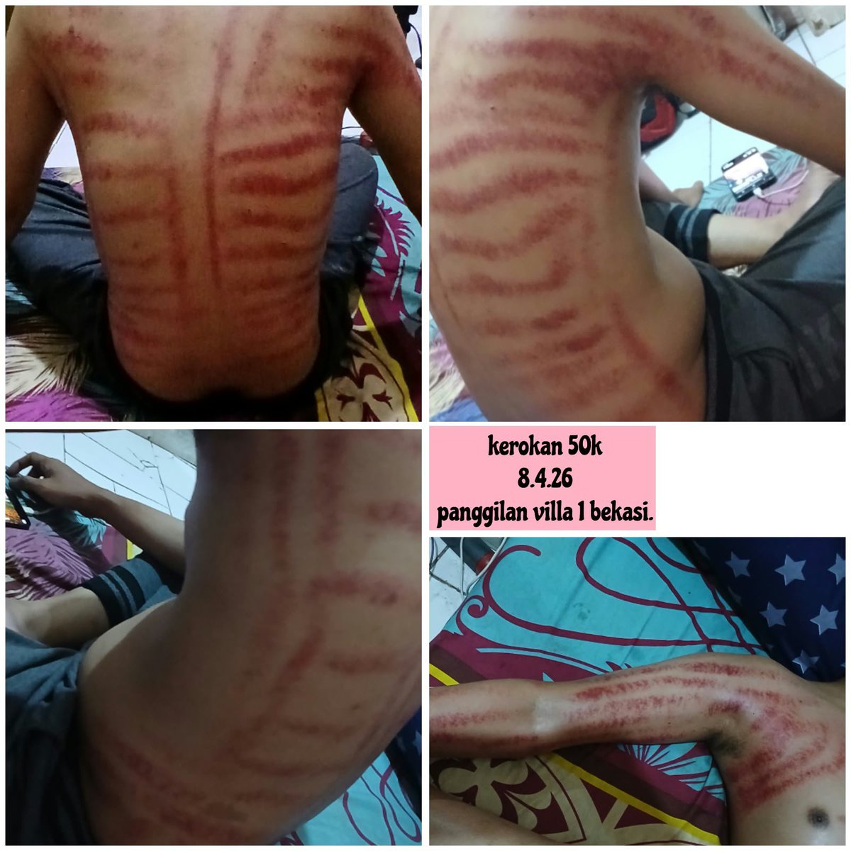Iisherli88's tweet photo. Tidak ngurut (ga bisa pijat)..
Hanya menerima kerok wanita dan pria aja. Harga Dm aja.. https://t.co/LOhIUMlCl7