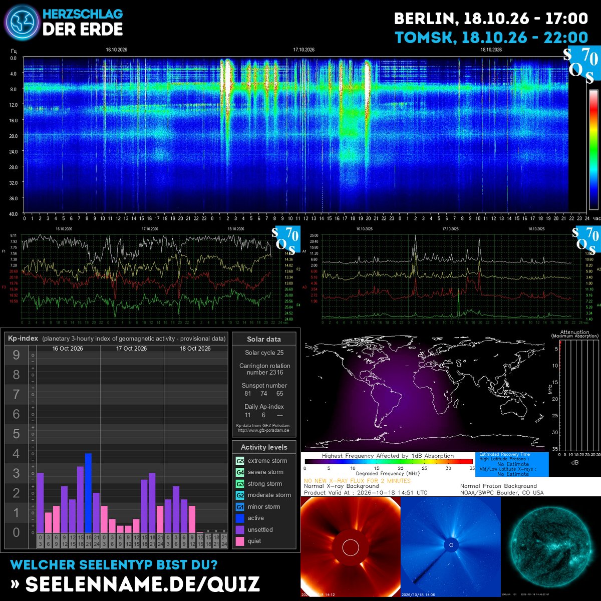 SchumannBotDE's tweet photo. 🌍✨ Today's cosmic waves carry powerful transformation energy! The Earth's heartbeat pulses with solar wisdom—tune in and align with the universe's flow. 🔵⚡ https://t.co/fEMtt6DdjI #CosmicEnergy #Schumann #SolarWisdom https://t.co/EoytVXFWrP