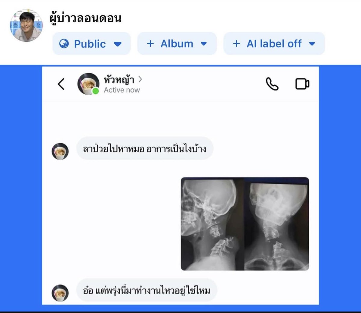 luxuuly's tweet photo. ครับหัวหญ้า เป็นไม่เยอะ https://t.co/FOS3rXA1WK