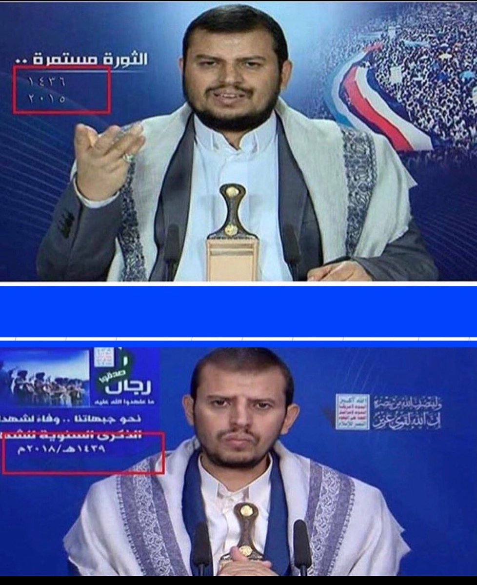 krszg_'s tweet photo. @idcactualy على طاري التكميم ههههههههههههههههههههههههههههههههههههههههههه https://t.co/KuhEPvX42z