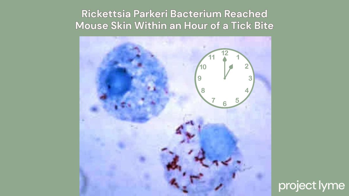 ProjectLyme's tweet photo. In mice, Gulf Coast ticks transmitted R. parkeri within one hour. While more research is needed, this is a good reminder that there is no "safe" attachment time for ticks! Learn more about the science: https://t.co/cmRVIsXPBT https://t.co/gCGNSdntyi