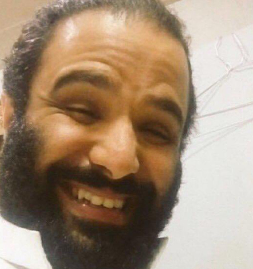 AlMa3b2y's tweet photo. @Tilowjfi غسلو اسنانه يباله تنضيف https://t.co/ntuwlzfAhK