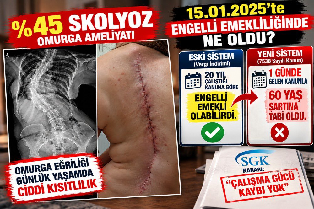 nazlitetk's tweet photo. Devletin belirlediği koşullara güvenerek hayatını planlayan vatandaşların beklentileri dikkate alınmalıdır. Emeklilik sistemindeki değişiklikler, insanların yıllarca verdiği emeği ve hukuki güvenlik ihtiyacını gözeterek uygulanmalıdır.

AYM Engelliyi Bekletme
#EngelliEmeklilikGelsin

@AYMBASKANLIGI