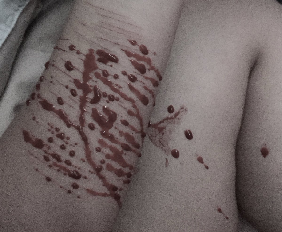 izzsh4rks's tweet photo. What a nighttt. Lwk took these on my iphone 6. I loveee it sm
Fake blood! Ai generated sfx makeuo!!! For Halloween!!!! 💗💗
#sfxmakeup #shtwtt 
Fake all fake all fake all https://t.co/oRuk4Y0YsE