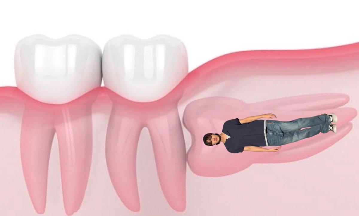 i_likeit606's tweet photo. 🦷 https://t.co/7tZLcX9LlT