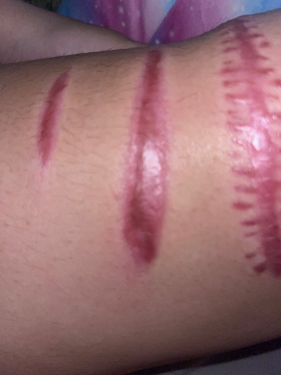 charls5000's tweet photo. @pickle_bbq hey atleast urs r pink and not doodoo brown for some reason u kinda cant see it but yh and its also vewy wrinkly https://t.co/Zvbc41JJ0u