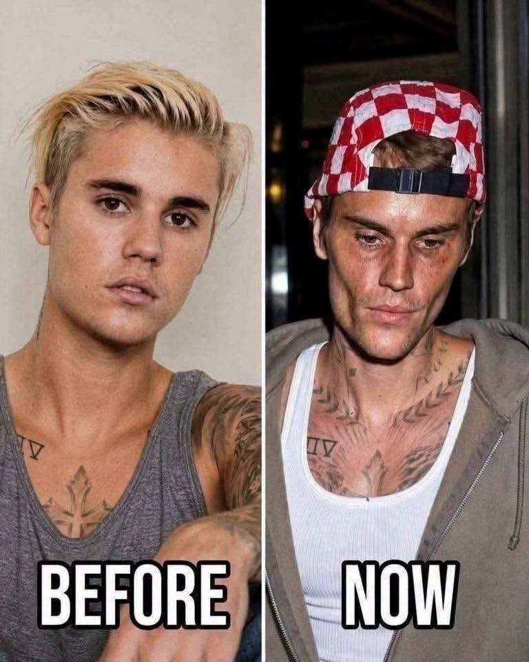 haji_musteey's tweet photo. Justin Bieber has allegedly opened up about his struggles living with HIV, revealing the emotional toll of dealing with personal challenges while living under the constant pressure of fame. 

“Living in the spotlight has never been easy. People see the fame, the money, and the success, but they don't see the personal battles you face behind closed doors. There are things I've struggled with privately that the world knows nothing about, and sometimes, the hardest part is pretending to be okay when you're not.”