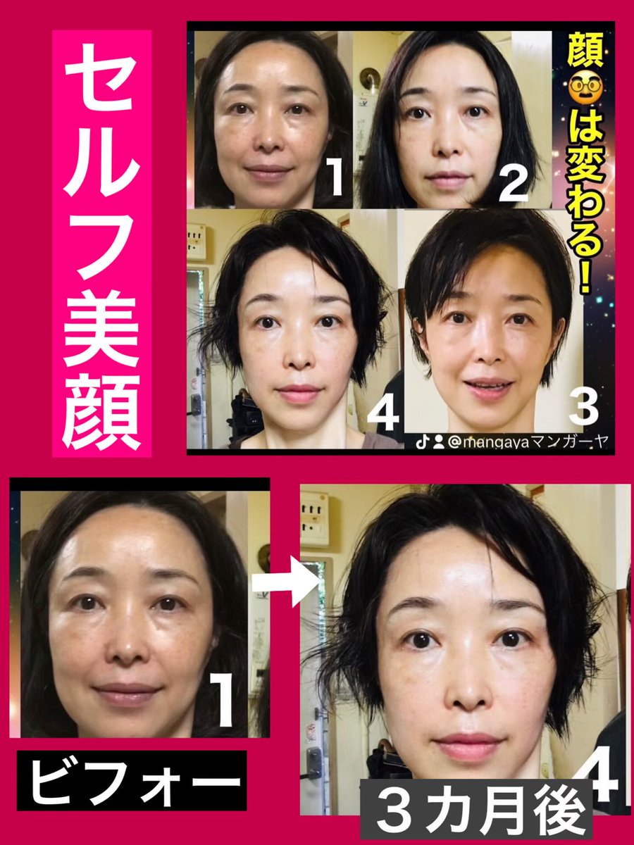 facial1_2020's tweet photo. エェー！！と驚く、
変身した、友達の顔‼️
セルフ美顔で、変わったとの事！？
本当かね！！
本当らしい😱‼️
興味ある方は、プロフェルリンク🔗からさ‼️詳細案内送ります！！ https://t.co/X1UWPnsJXA