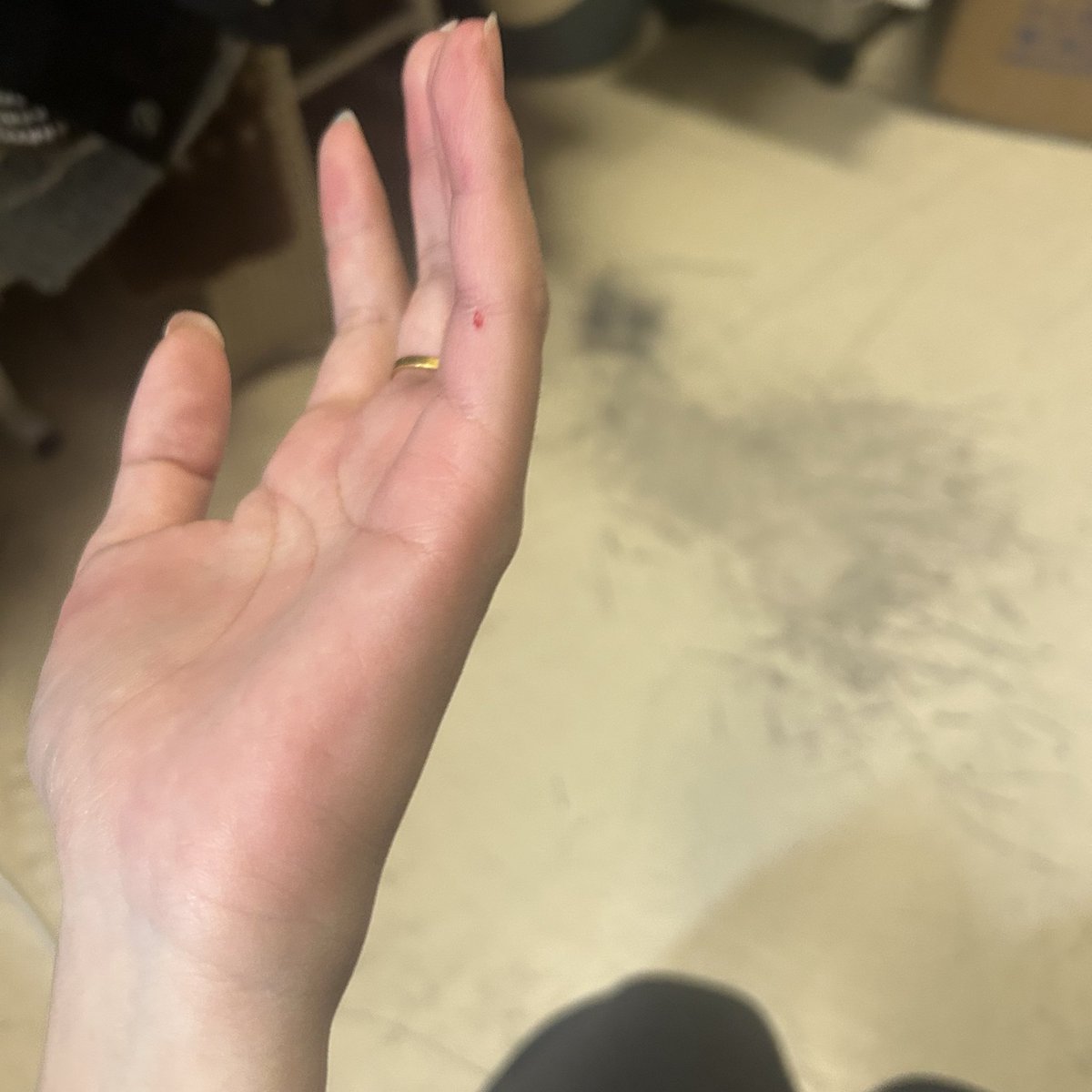 angwithwings's tweet photo. 气死我了啊一大早的从床上摔下去，摔的我流血了也破皮了一个美好的早上就这样摔出来。 https://t.co/ODwSyLlmCb