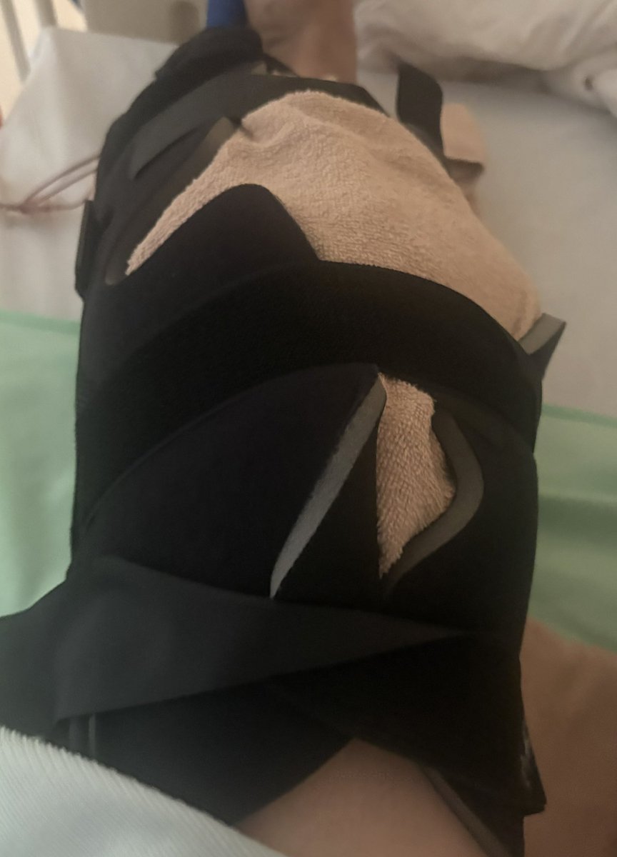 g1545615's tweet photo. 終わりましたー！
左足は冷やす装具が付いてるのとまだ麻酔が効いててよくわからないけど
右足にはメス入れないで良かったって事はわかるー✌️ https://t.co/a7ltwYBnha