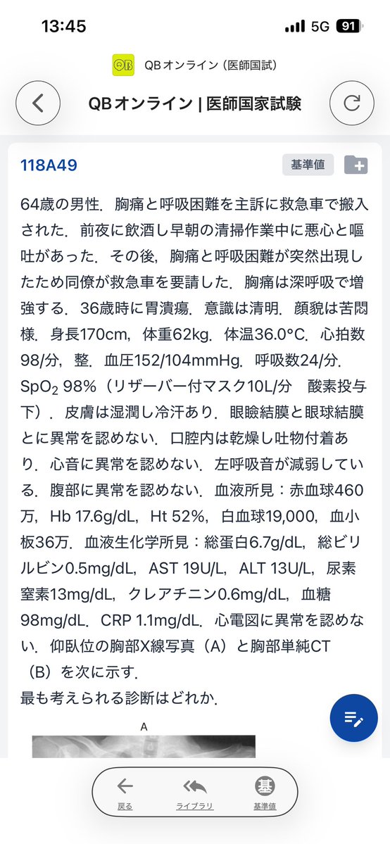 medicalhackerm's tweet photo. 答え気胸じゃないの❓ https://t.co/pOFCg2LBzG