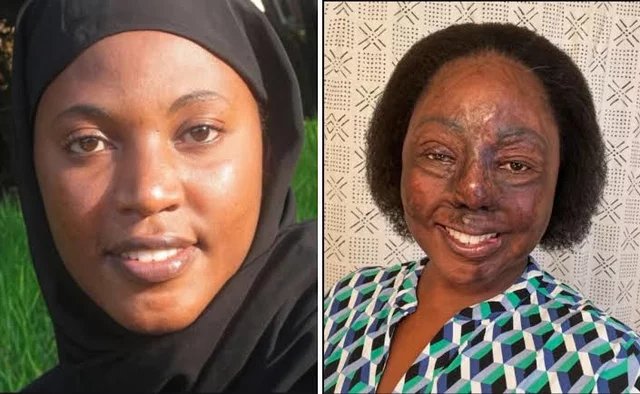 omusuugawaKLA's tweet photo. Second chances don't always give you your old face back.🥹

Sometimes they give you a new reason to smile.

Her beauty didn't leave. It just learned to survive. ❤️ https://t.co/WhzHaY2IDJ