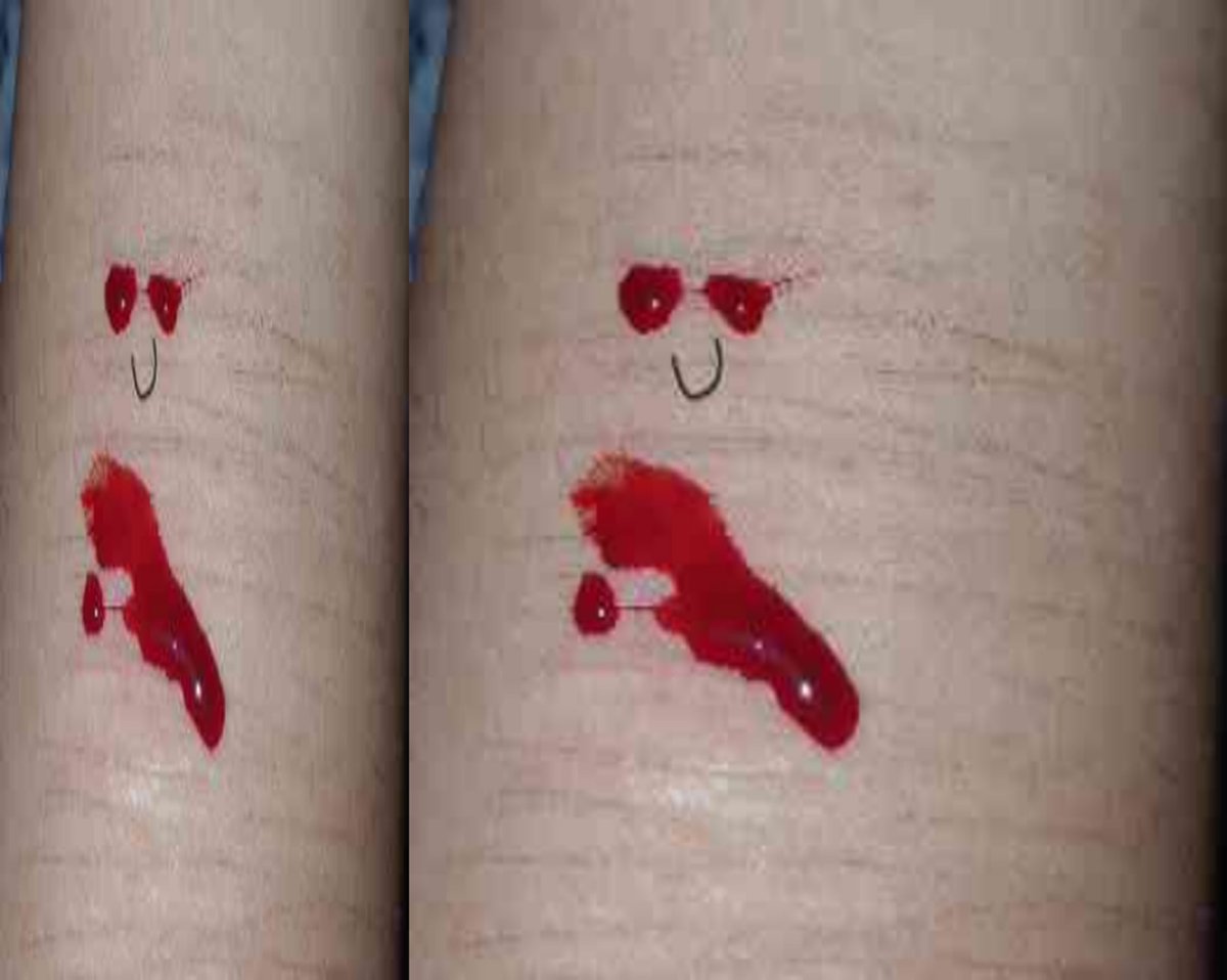 su1cidsan's tweet photo. Parece q tuviera lentes #sh #sht #fake #fake #makeupsfx https://t.co/aTdPLvFHXJ