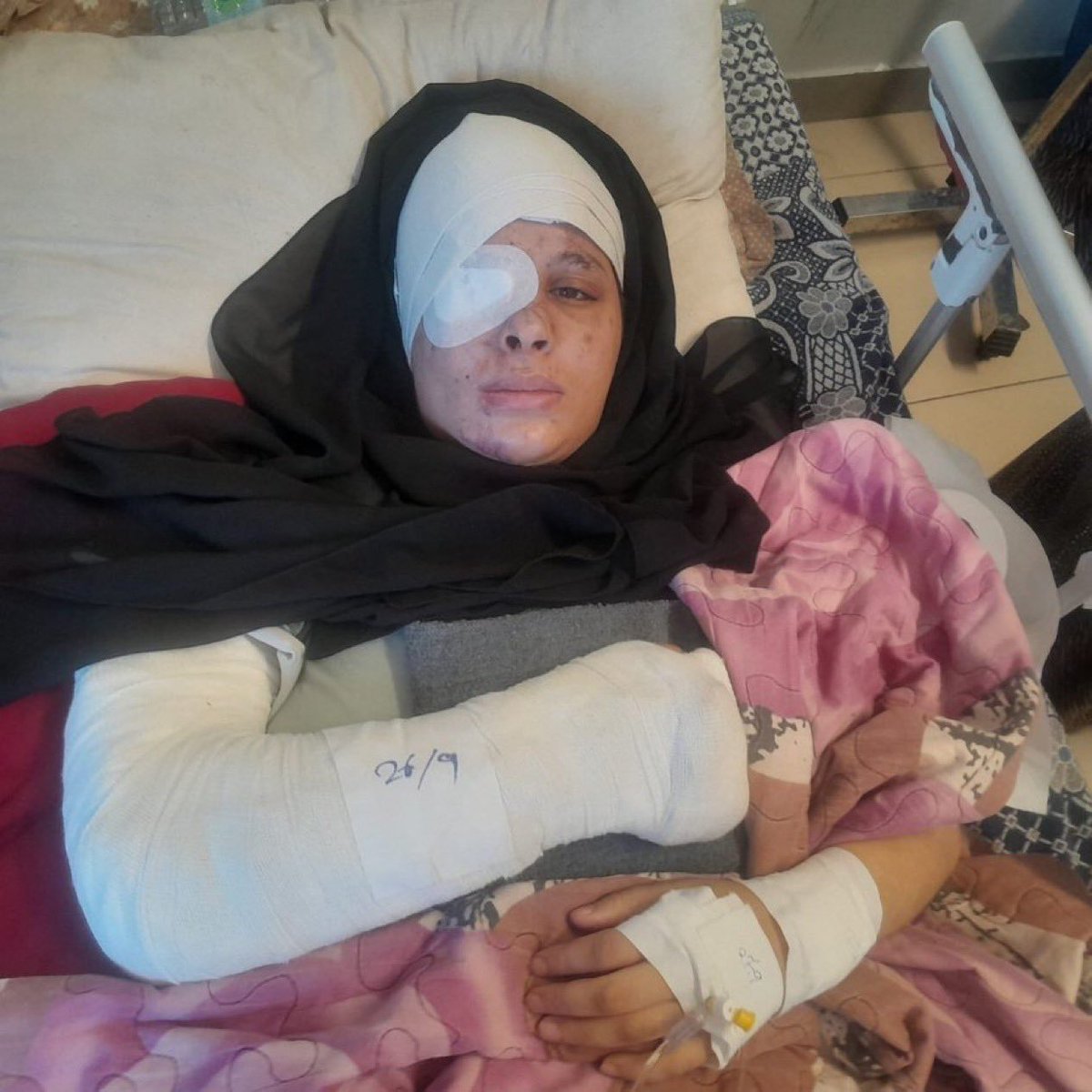m78203's tweet photo. Dina Miqdad... İsrail katliamından kurtulan, gözü oyulmuş ve ağır yaralanmış bir kadın.

Dünya unutmaya çalışırken Dina'yı hatırlayın.

Eğer sesi duyulmuyorsa, onun sesi olun.

İşgalin suçlarını ifşa etmeyi bırakmayın. https://t.co/yAvks1rMb2