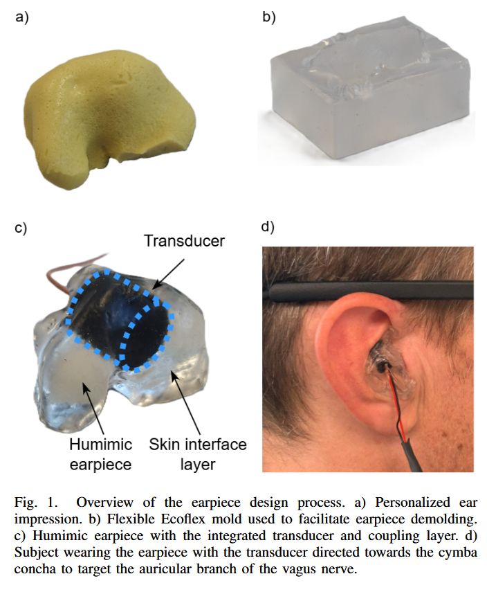 pulp_platform's tweet photo. We present a wearable US stimulation system combining a personalized, dry-coupled earpiece with a battery-powered, wireless US probe. Dive into our paper "Towards an Earpiece for Wearable and Dry Ultrasonic Vagus Nerve Stimulation" https://t.co/GSdyJuvmiL https://t.co/F0WwFjK2qd