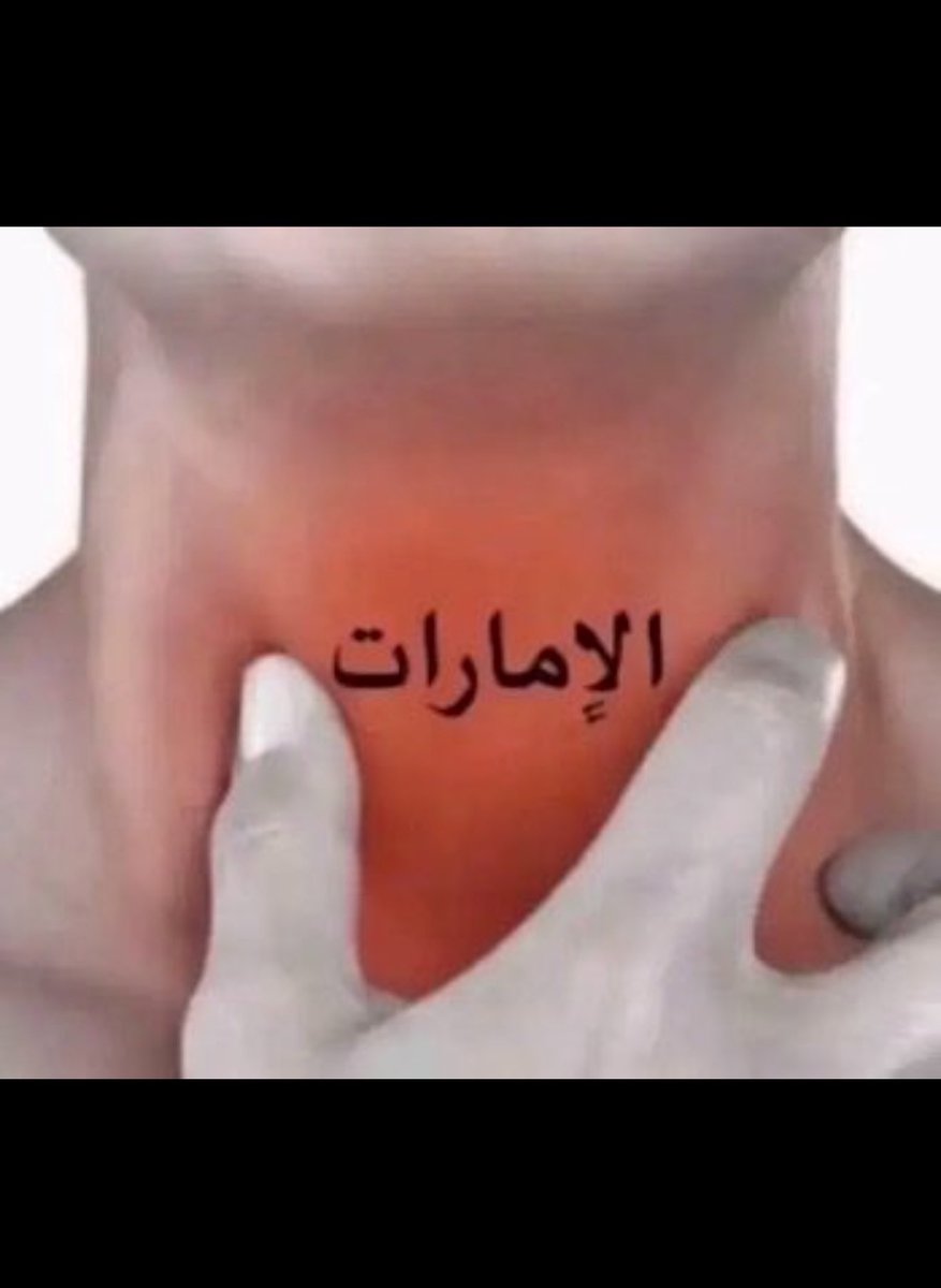 obaidALBL1's tweet photo. للعلم فقط https://t.co/NZlcEGd3qx