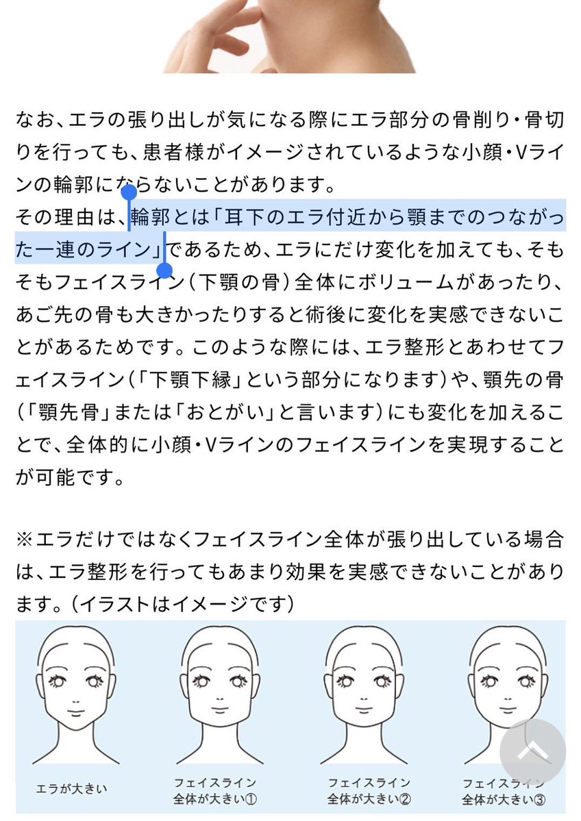 輪郭とは「耳下のエラ付近から顎までのつながった一連のライン」
輪郭が整ってないのに鼻と目から整形して成功してる女の子見たことない。。
鼻→輪郭でやるとほぼ確で鼻の再手術になるけど、それだと鼻先の皮膚厚くなっていく気がする。
一回厚くなった皮膚って二度と戻せないからね、、、 https://t.co/HZHGQtex0C