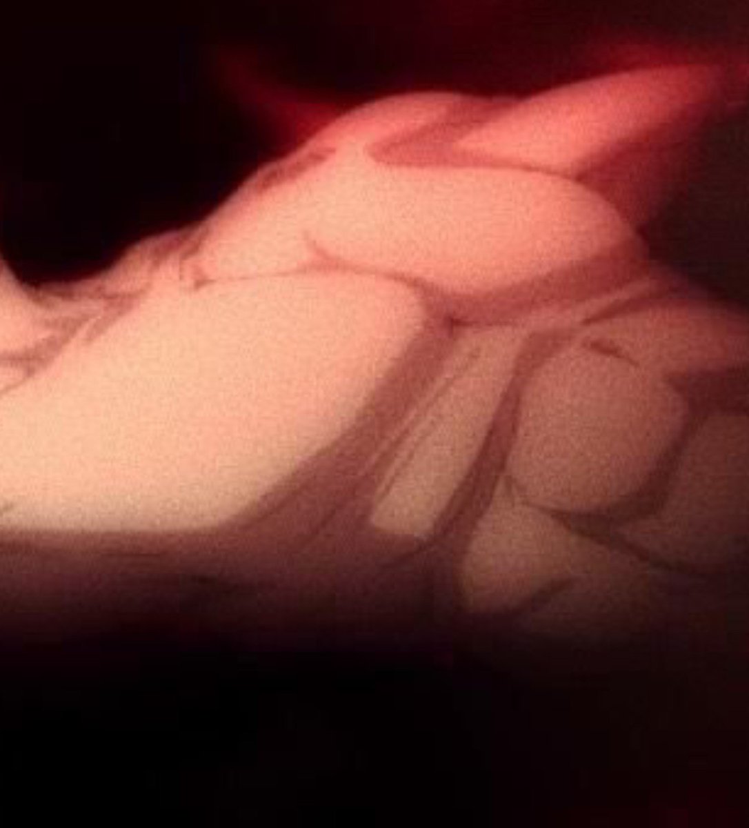 G1llgamesh's tweet photo. Gilgamesh's chest https://t.co/ypIa3WX8wC
