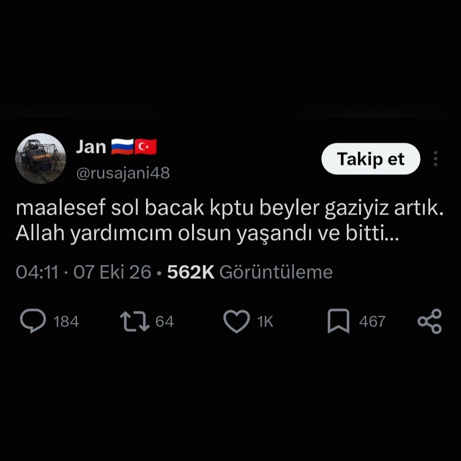 Globalite68's tweet photo. 🇷🇺 Rusya için savaşan bir Türk, tek bacağını kaybettiğini açıkladı. https://t.co/b8xuJAPuLf