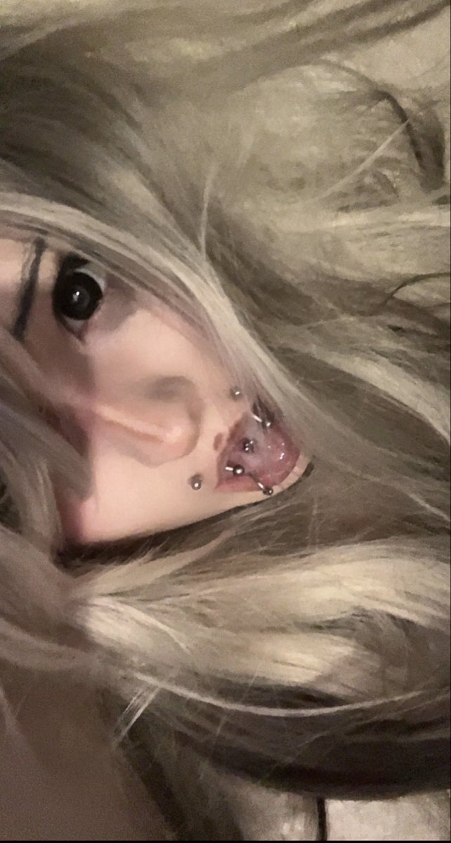 derpycatsies's tweet photo. @dollwasted @626company626 @marnislides u look genuinely retarded omg get off her dick ugly skank https://t.co/mFHDDrGK77